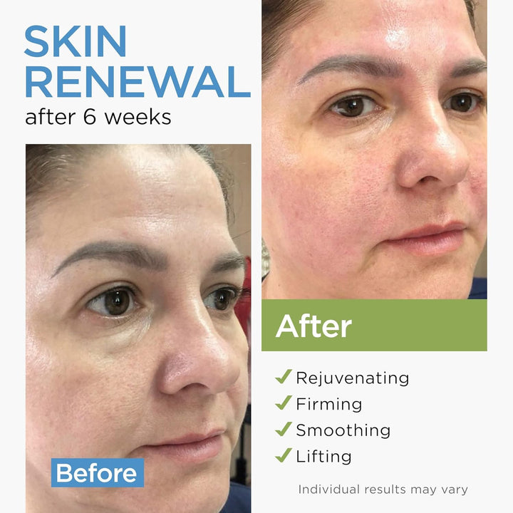 Crema facial hidratante de colágeno antienvejecimiento con células...