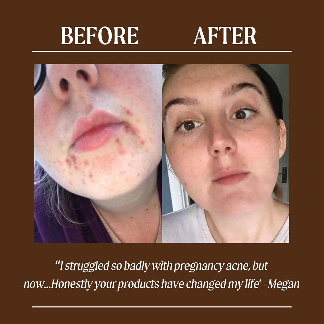 UPCIRCLE Hidratante facial con polvo de argán de 1.7 onzas, crema n...