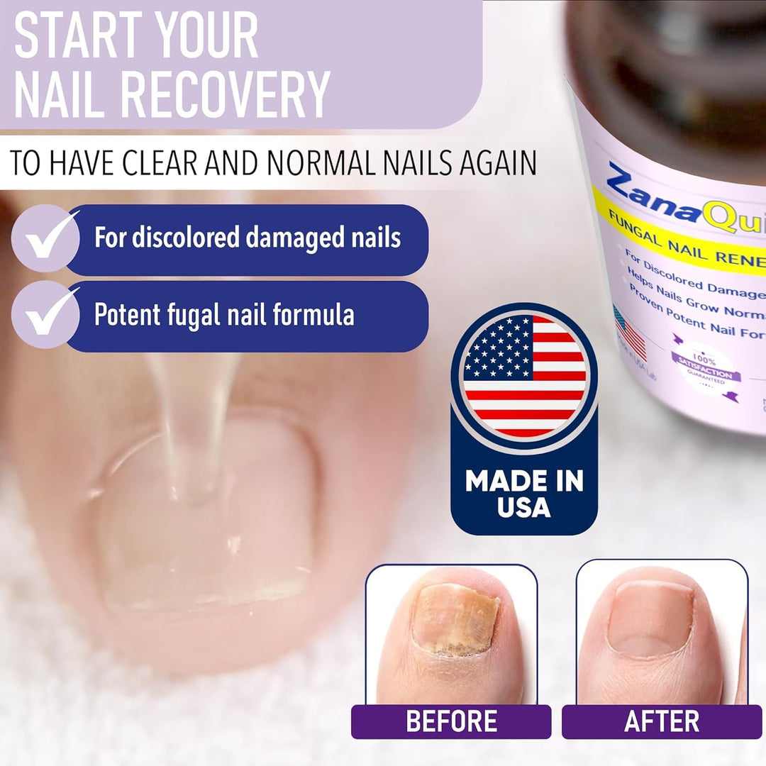 ZanaQuick Sistema de renovación de uñas de 2 pasos \u2013 Solución...