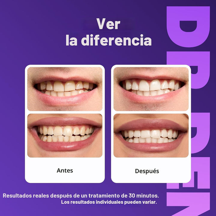 DRDENT Tiras blanqueadoras de dientes moradas, 21 tratamientos, seg...