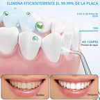 Irrigador dental de agua para limpieza de dientes y hilo dental con funda de tamaño de viaje, irrigador oral recargable, irrigador dental portátil KOOVON para adultos, IPX7 impermeable