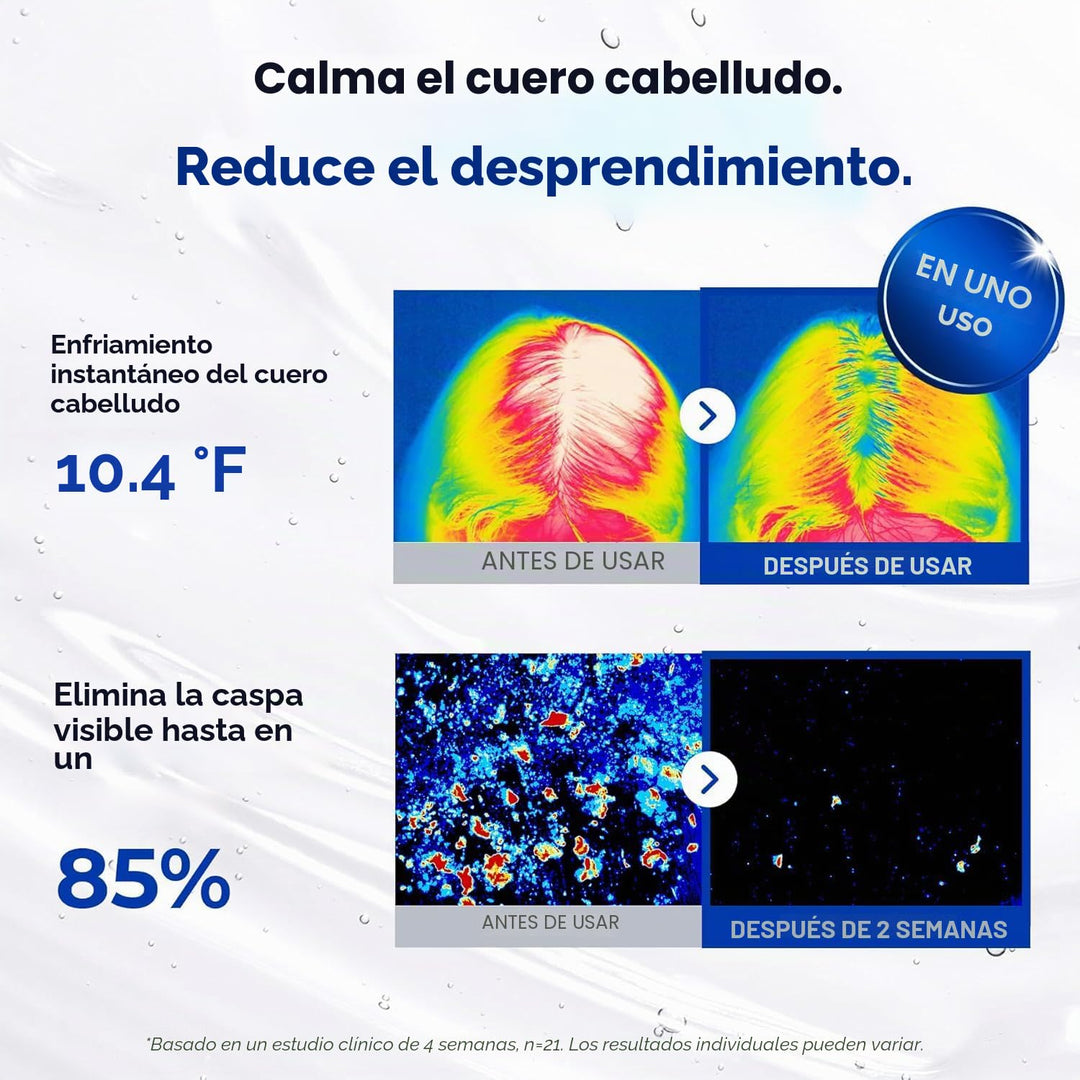 EPAIS Suero potenciador del cuero cabelludo (cuidado completo del c...