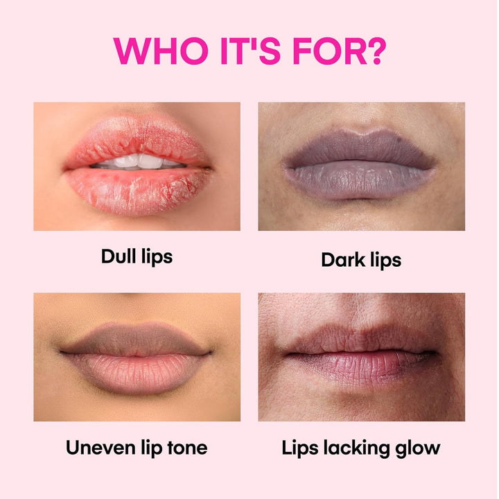 KissBea Aclarador de labios para labios oscuros: para fumadores, la...