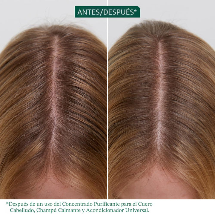 Biolage Scalp Sync - Concentrado purificador - Tratamiento exfolian...