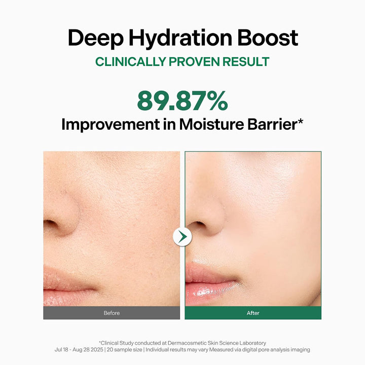 coeternal Crema ultra intensiva, hidratante facial coreano hidratan...