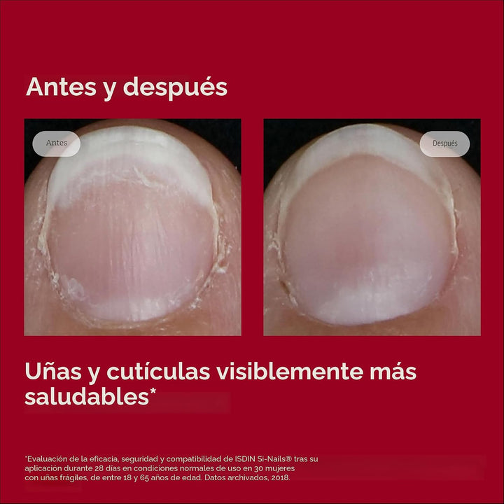 ISDIN SI-NAILS - Tratamiento de suero para cutículas fortalecedor d...