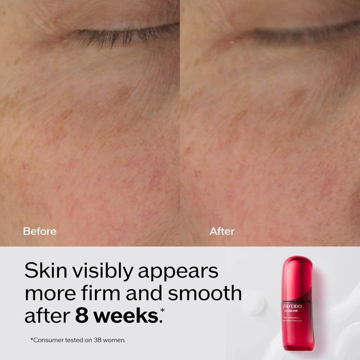 Shiseido Ultimune Power Infusion Serum - Suero facial ligero innova...