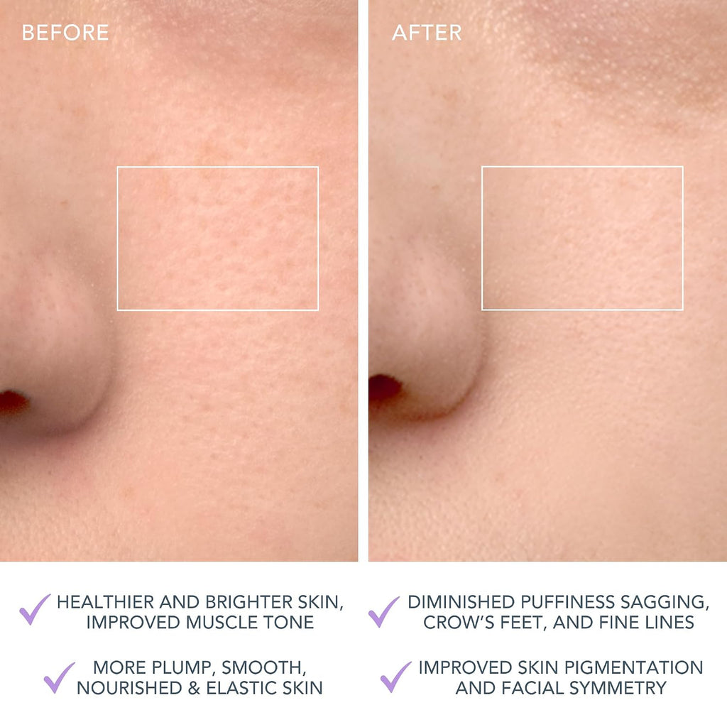 FOREO LUNA 4 Cepillo de limpieza facial - Masajeador facial reafirmante - Cuidado antienvejecimiento - Mejora la absorción - Herramientas simples para el cuidado de la piel - Piel sensible
