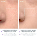 FOREO LUNA 4 Cepillo de limpieza facial - Masajeador facial reafirmante - Cuidado antienvejecimiento - Mejora la absorción - Herramientas simples para el cuidado de la piel - Piel sensible
