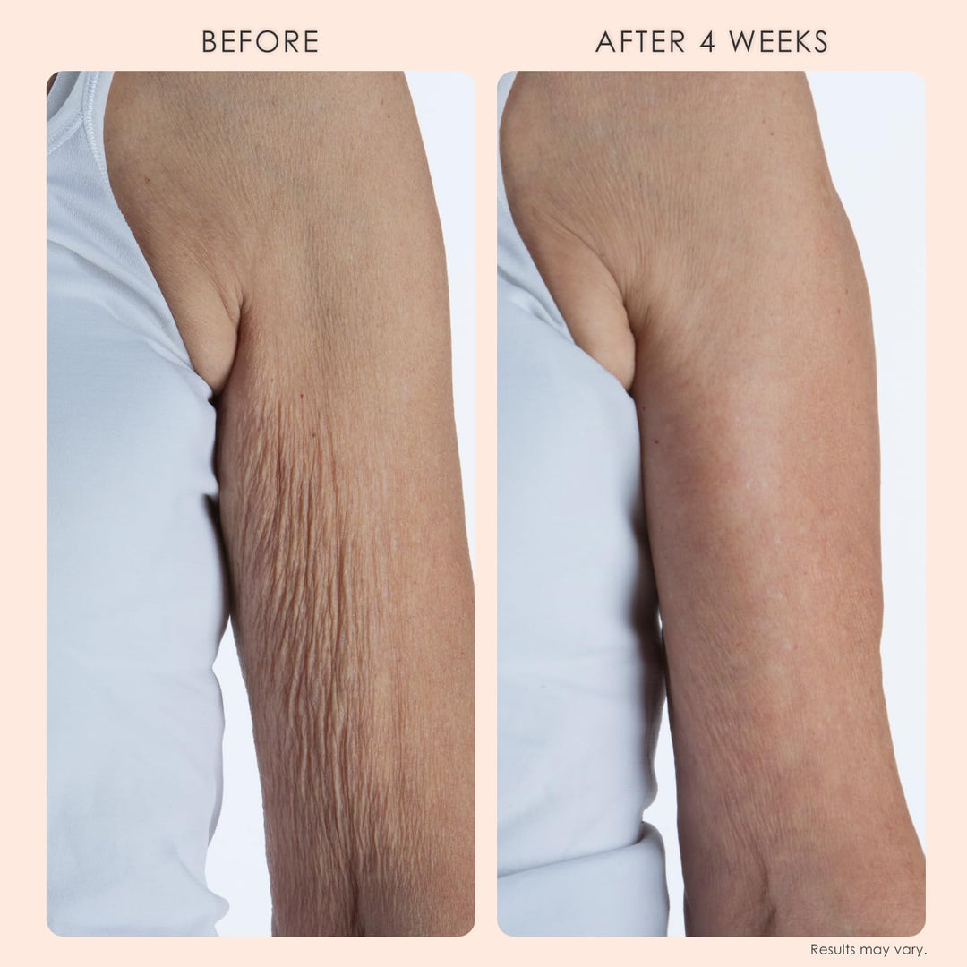 BODY FIRM Crepe Erase Tratamiento de Reparación Corporal, Crema Ant...