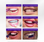 Hismile V34 - Tiras blanqueadoras de dientes, paquete de 28 tiras