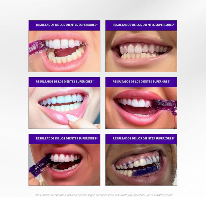 Hismile V34 Tiras blanqueadoras, tiras blanqueadoras de dientes, ti...