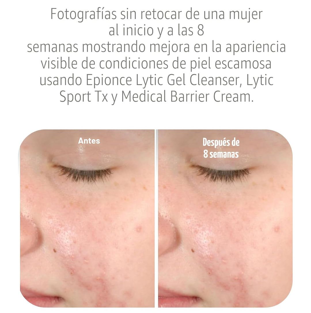 Epionce Lytic Gel Cleanser - Limpiador facial y removedor de maquil...