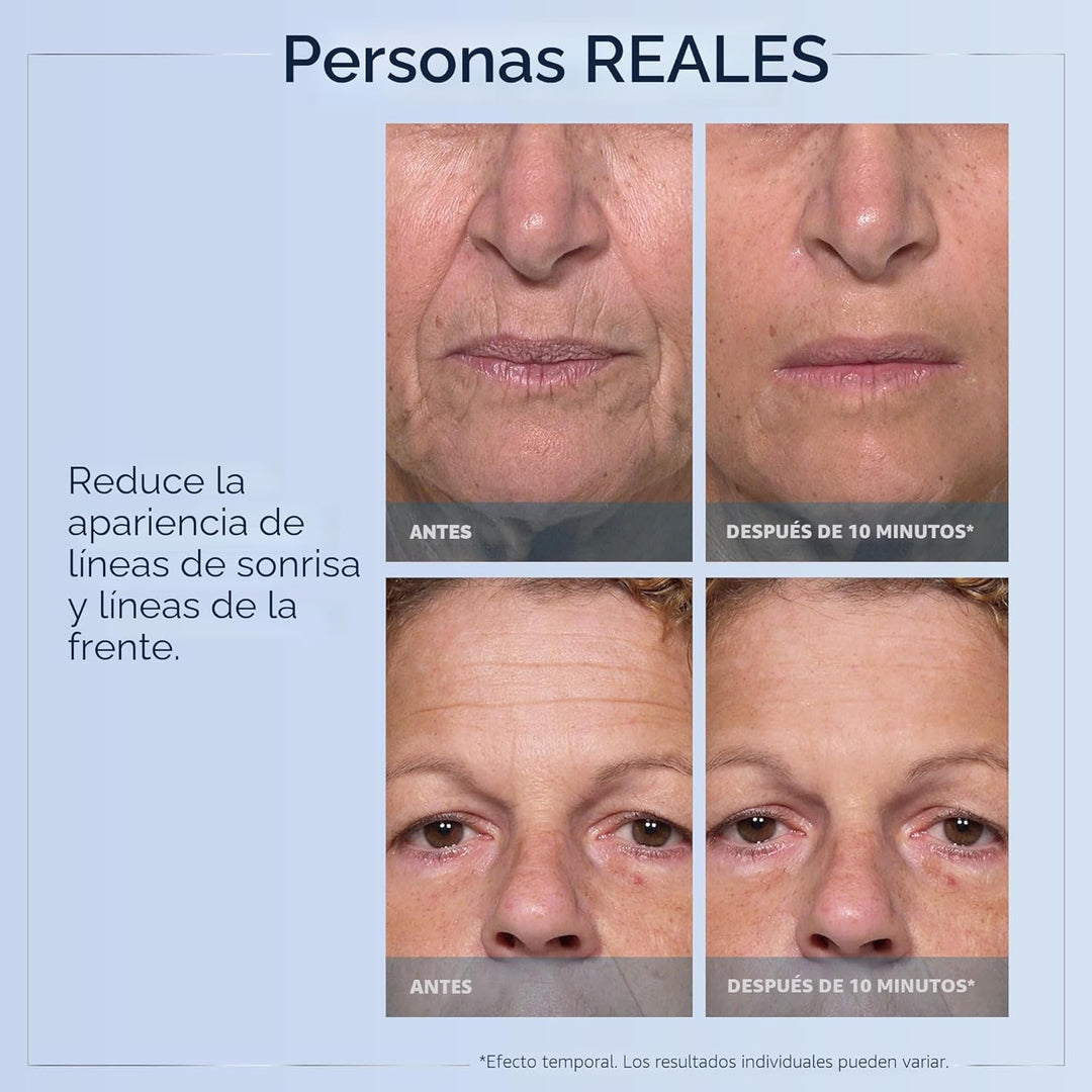 Plexaderm Suero de ojos de reducción rápida: reduce visiblemente la...