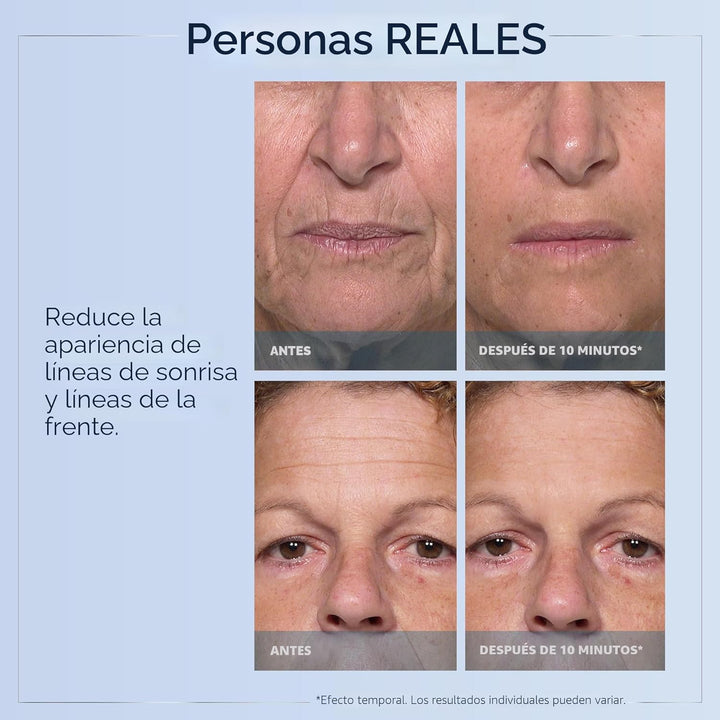 Plexaderm Suero de ojos de reducción rápida: reduce visiblemente la...