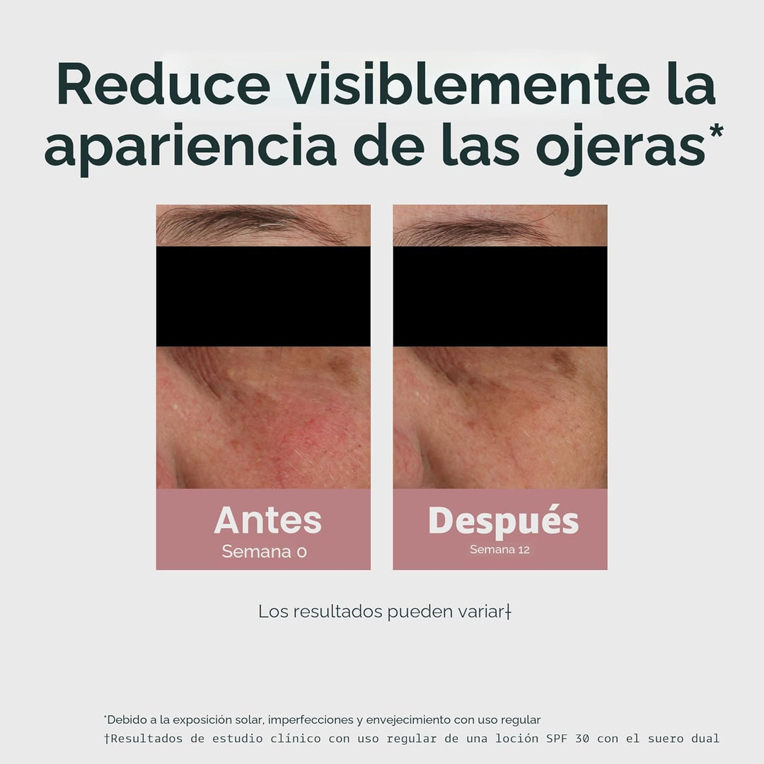 Crema para ojos Eucerin Radiant Tone Corrector de Círculos Oscuros,...