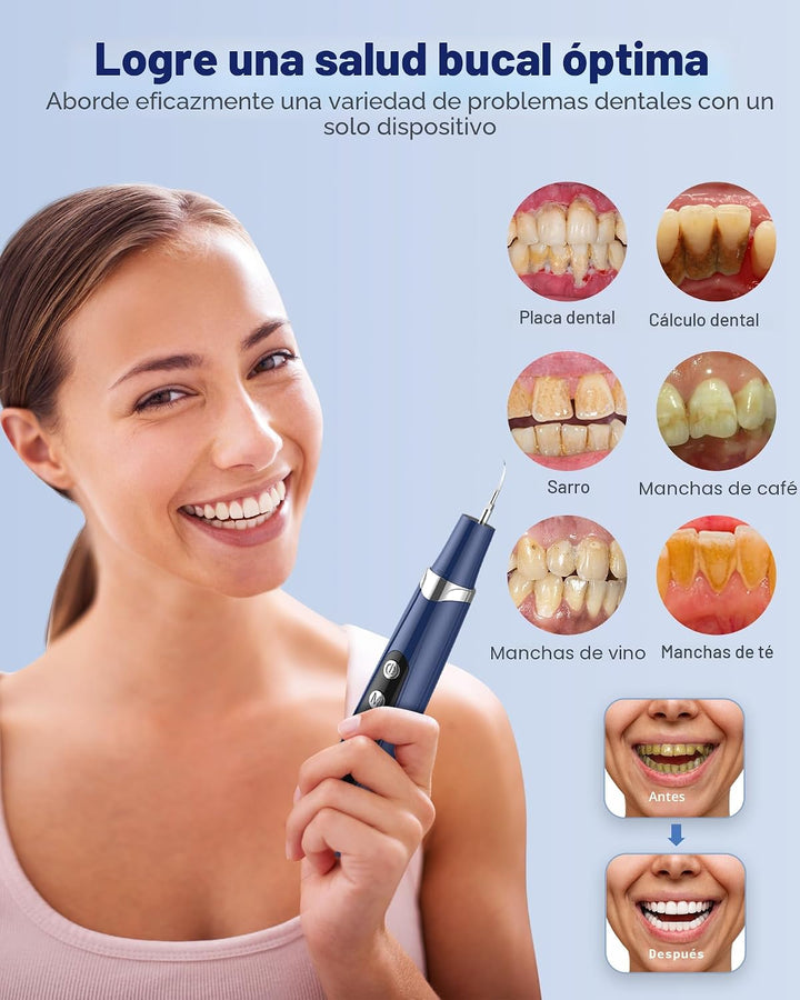 Removedor de placa para dientes, removedor de sarro para dientes co...