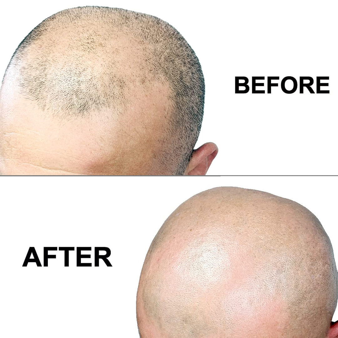 Omnishaver - Afeitadoras bidireccionales prémium para hombres y muj...