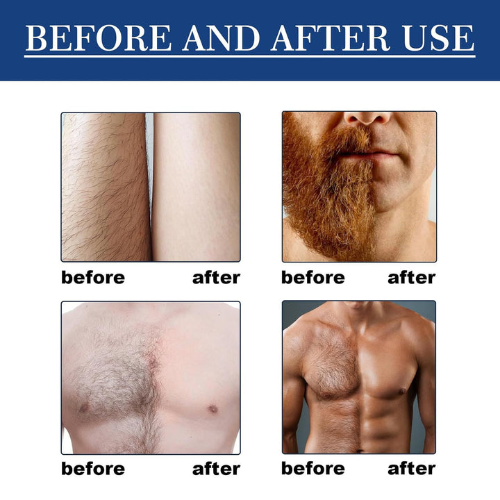 Spray de depilación para hombres, extracto de plantas, spray de dep...