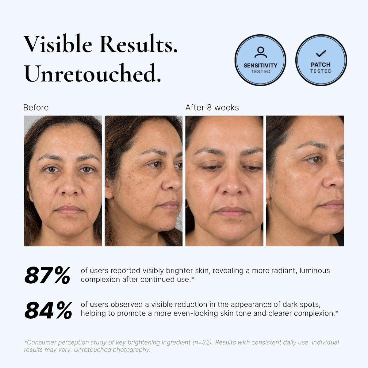 EnaSkin Crema correctora de manchas oscuras para el cuerpo y elimin...