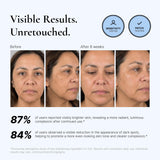 EnaSkin Corrector de manchas oscuras para rostro y cuerpo - 5% ácid...