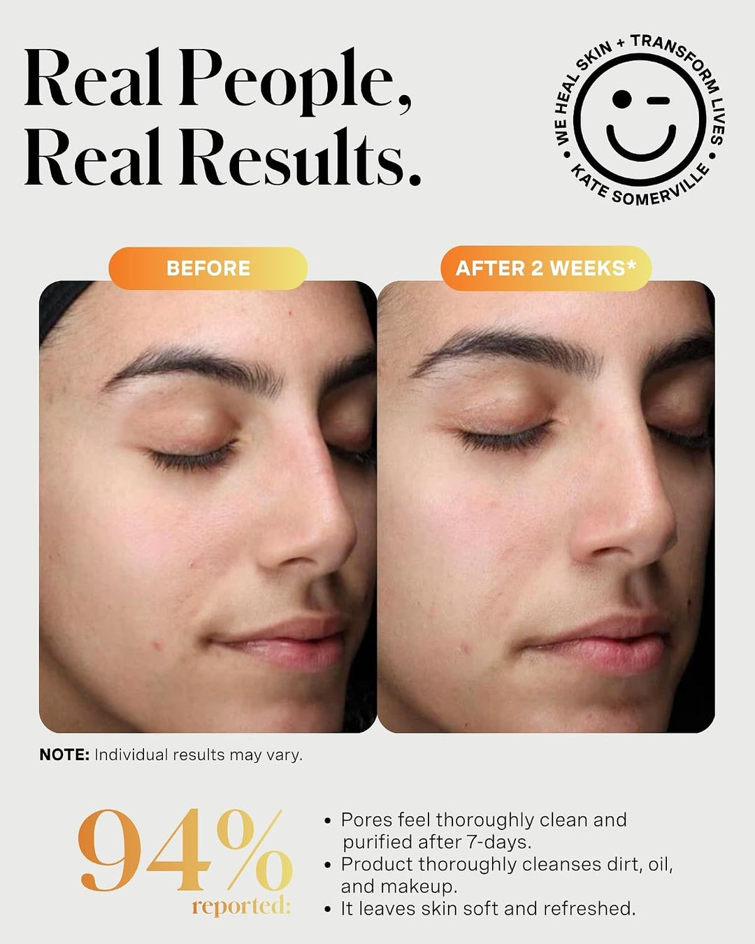 Kate Somerville ExfoliKate Limpiador \u2013 Lavado facial exfoliant...