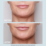 CLARINS Máscara facial Cryo-Flash | Efecto de elevación visible en...