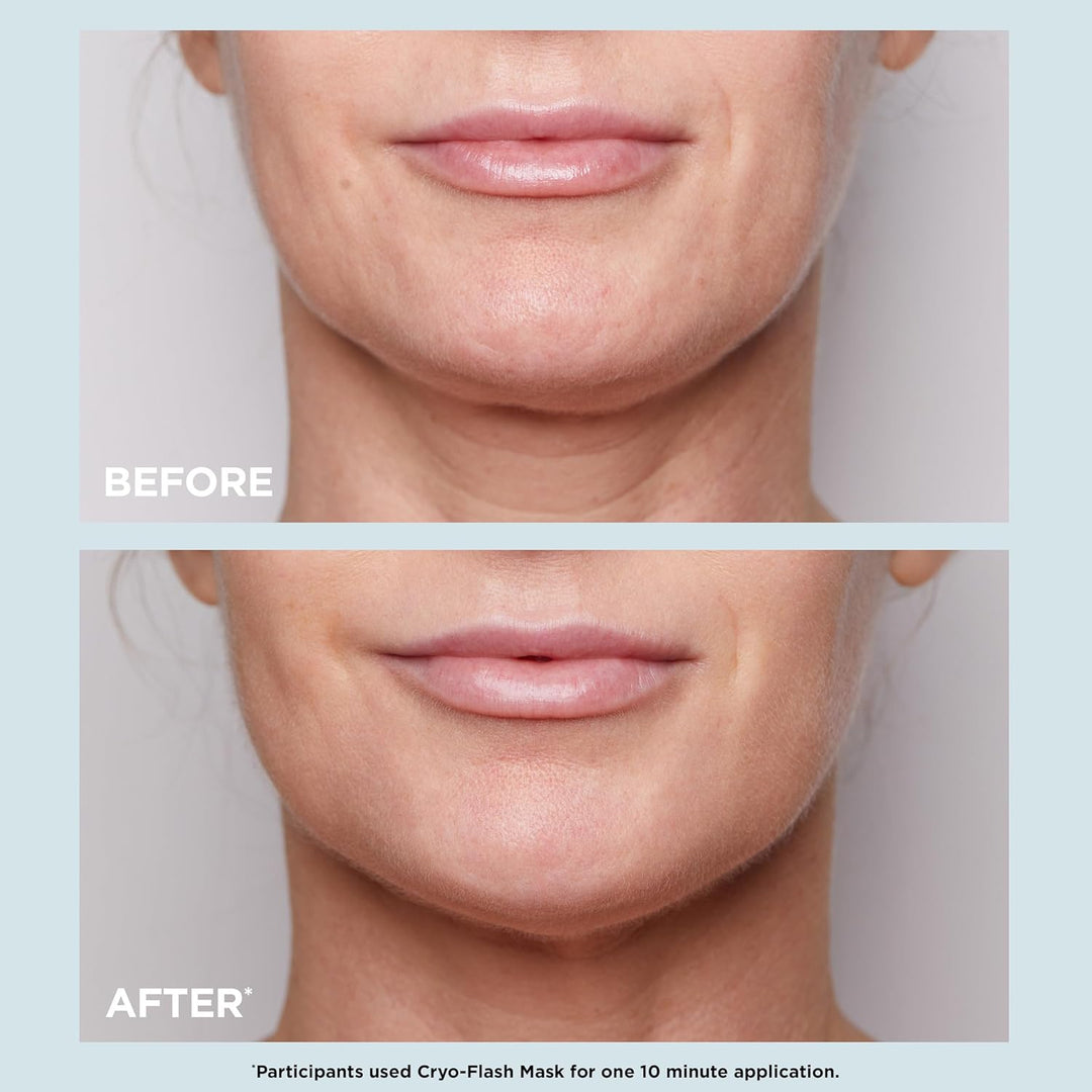 CLARINS Máscara facial Cryo-Flash | Efecto de elevación visible en...