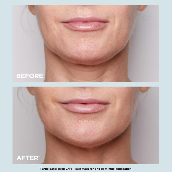 CLARINS Máscara facial Cryo-Flash | Efecto de elevación visible en...