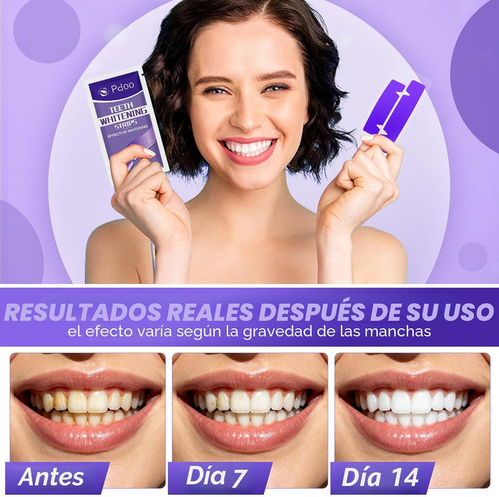Tiras blanqueadoras de dientes moradas \u2013 42 tiras blanqueadora...