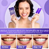 Tiras blanqueadoras de dientes moradas - 32 tiras blanqueadoras de...