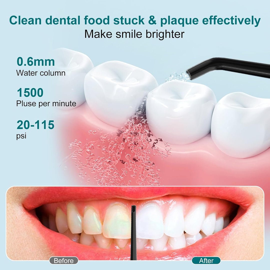 Nicefeel - Irrigador bucal inalámbrico de agua de 300ML, sin BPA, p...