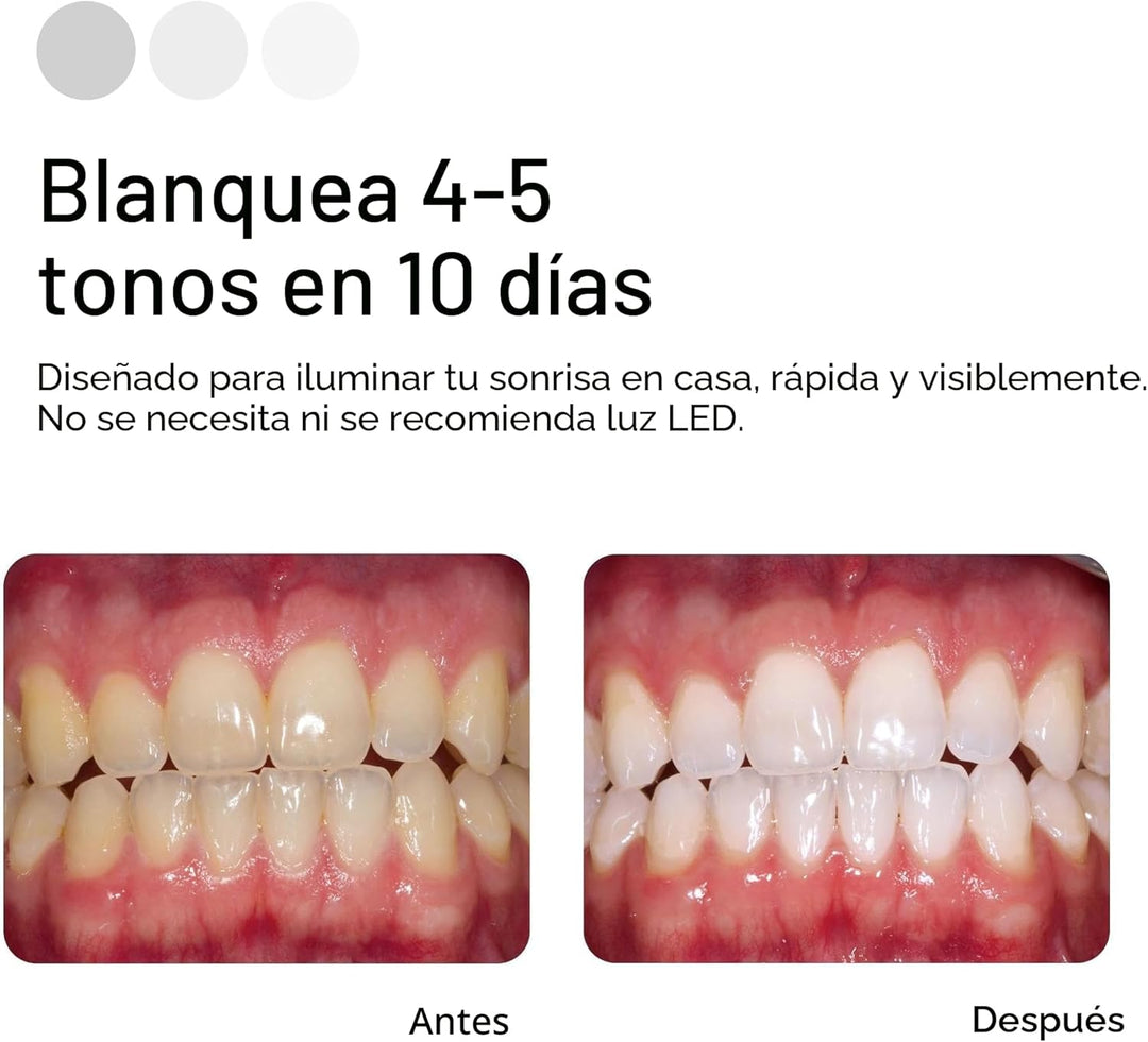 Opalescence Go 15% Mint - Bandejas blanqueadoras de dientes precarg...