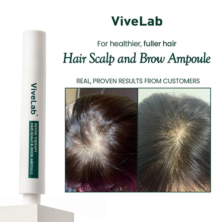 Suero para el Cuero Cabelludo y el Cabello para Cabello Fino de Viv...