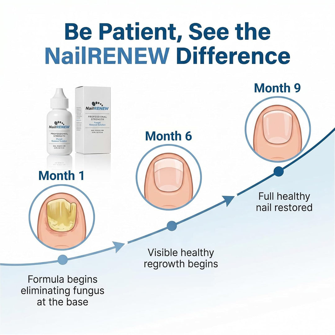 NailRENEW Antifúngico - Fuerza profesional, tratamiento de hongos c...