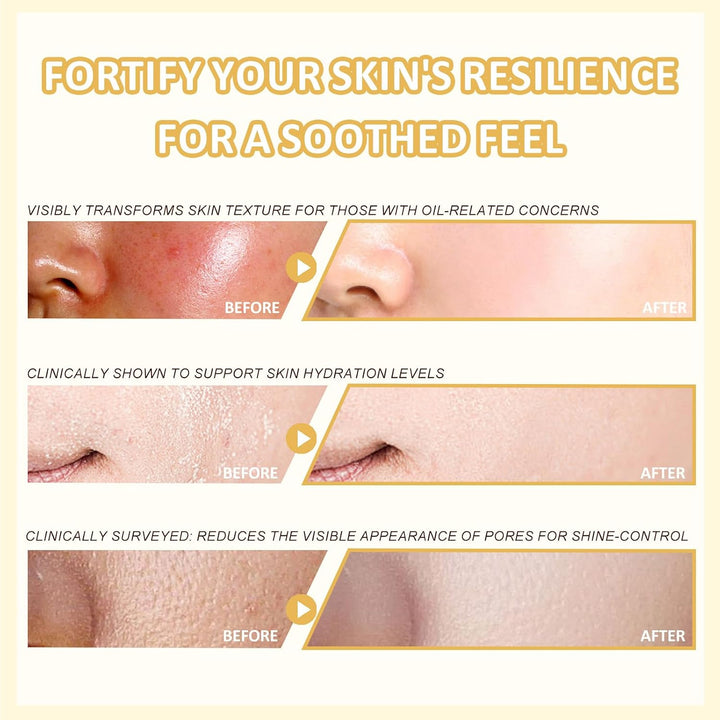 FOR SADOER Rice Niacinamide Skincare Set \u2013 Kit de 6 piezas de...