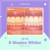 Smileactives Pluma Blanqueadora de Dientes para Sonrisa Blanca, Bla...