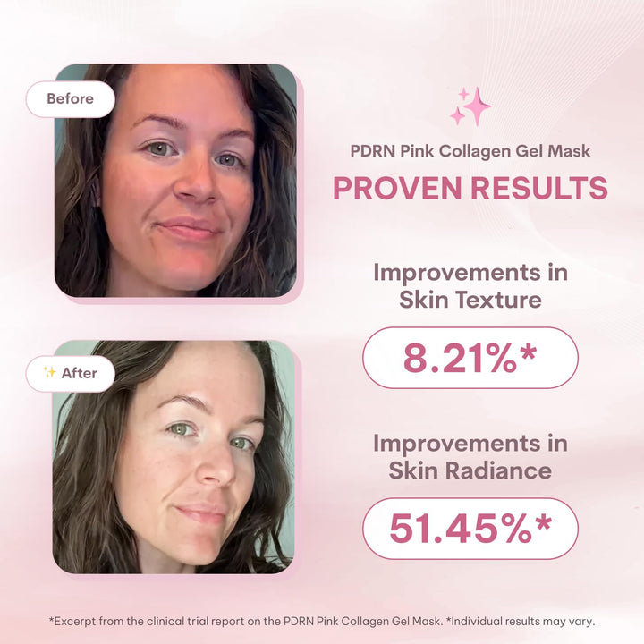 Quasi Salmon PDRN - Máscara facial de gel coreano para el cuidado d...