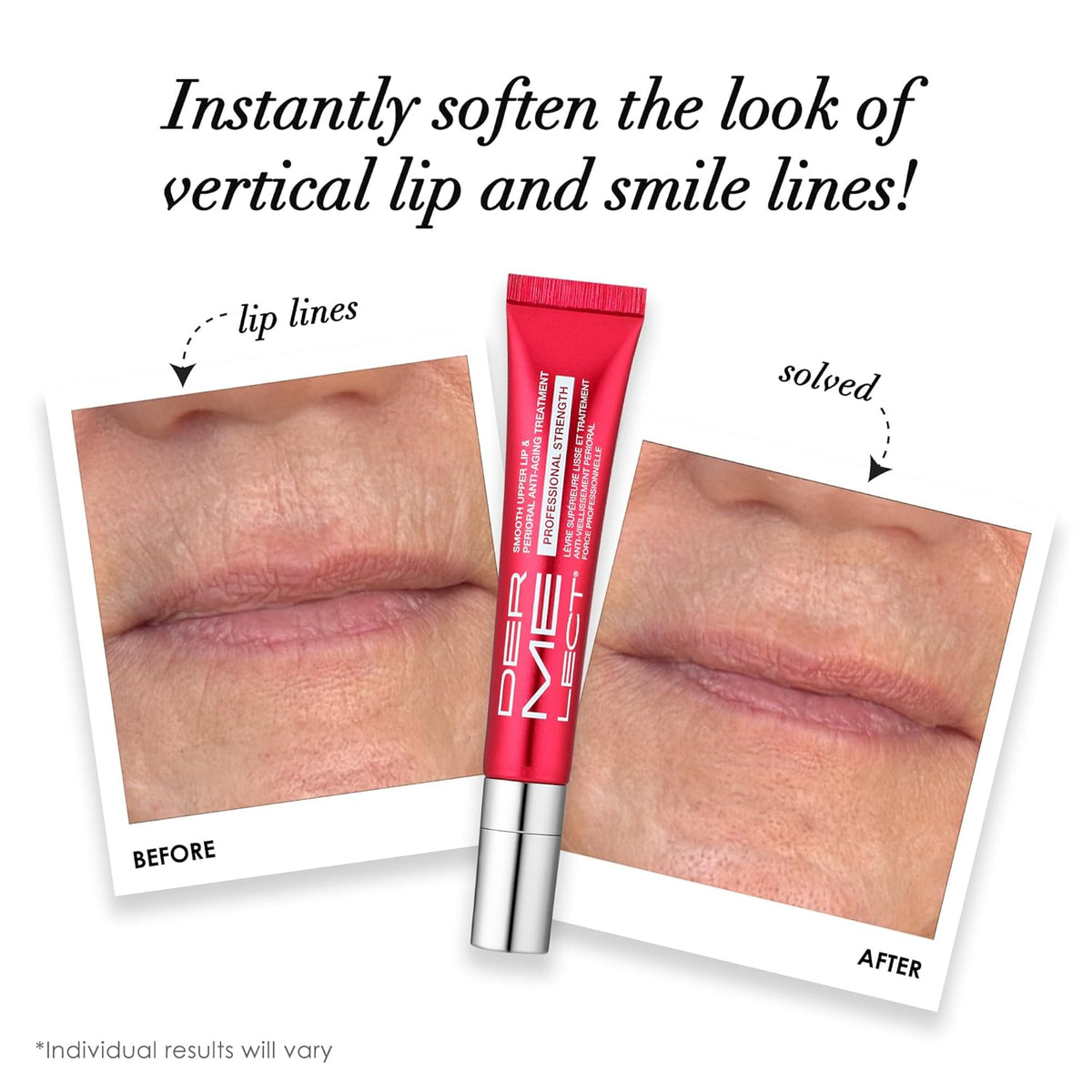 Dermelect Tratamiento antienvejecimiento para labios superiores lis...