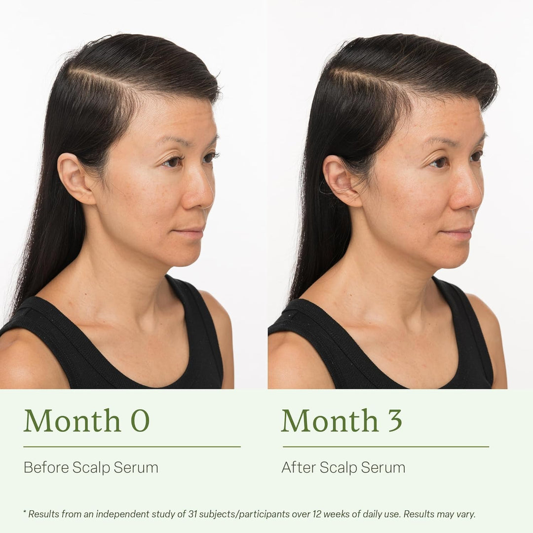 Divi Scalp Serum for Thinning Hair Clinically Tested, Non-Greasy Fo...