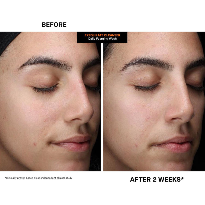 Kate Somerville ExfoliKate Limpiador \u2013 Lavado facial exfoliant...