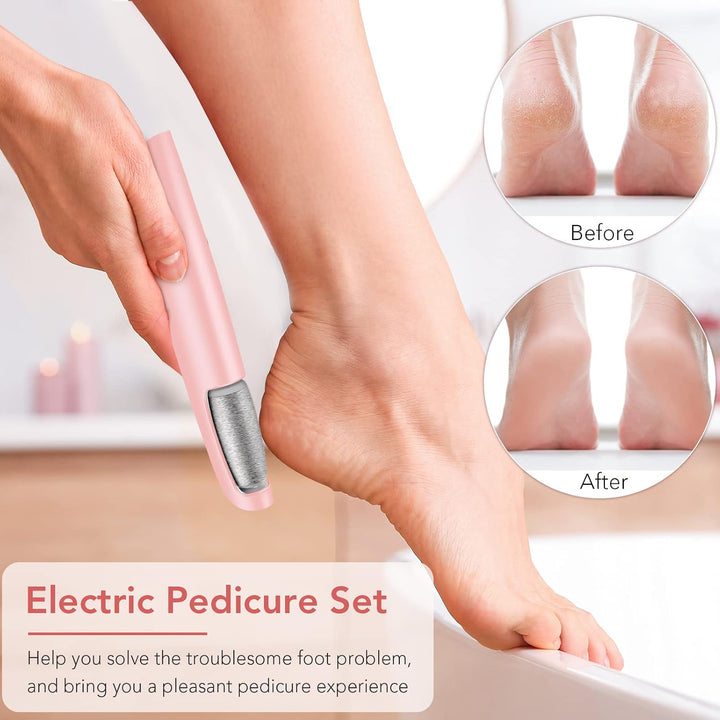 Removedor eléctrico de callos para pies, kit profesional de pedicur...