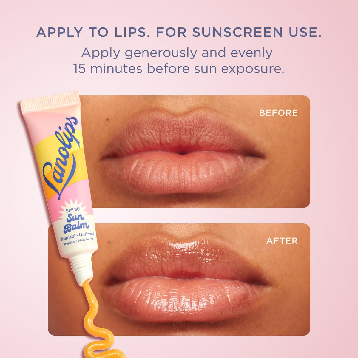 Lanolips Sun Balm Tropical SPF 30 Bálsamo labial y soporte para tel...