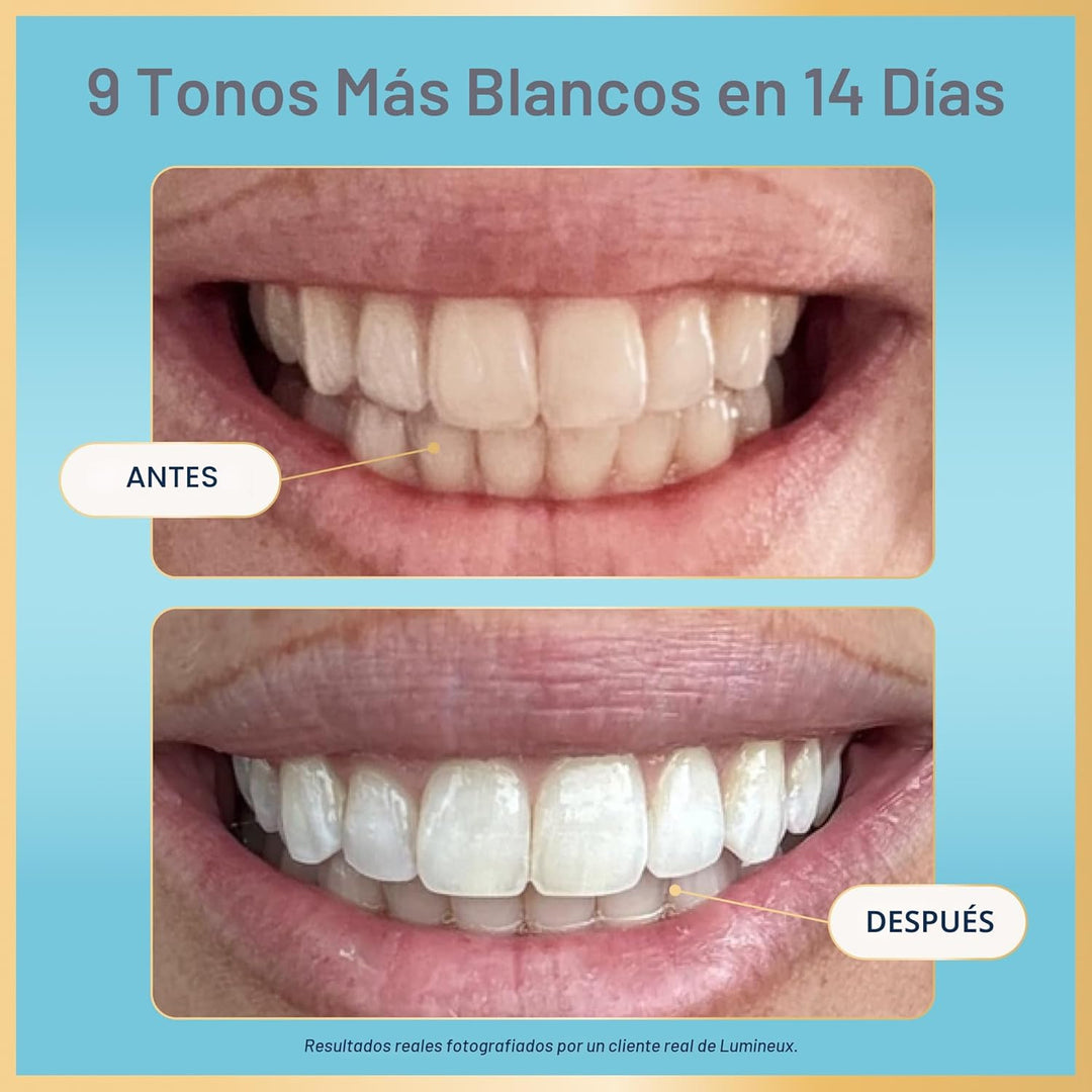 Kit de tiras blanqueadoras dentales Lumineux - 9 tratamientos - sin...