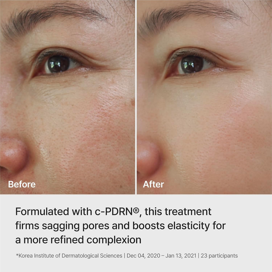 REJURAN® Máscara de elevación con infusión de ampolla, DOT™ c-PDRN®...