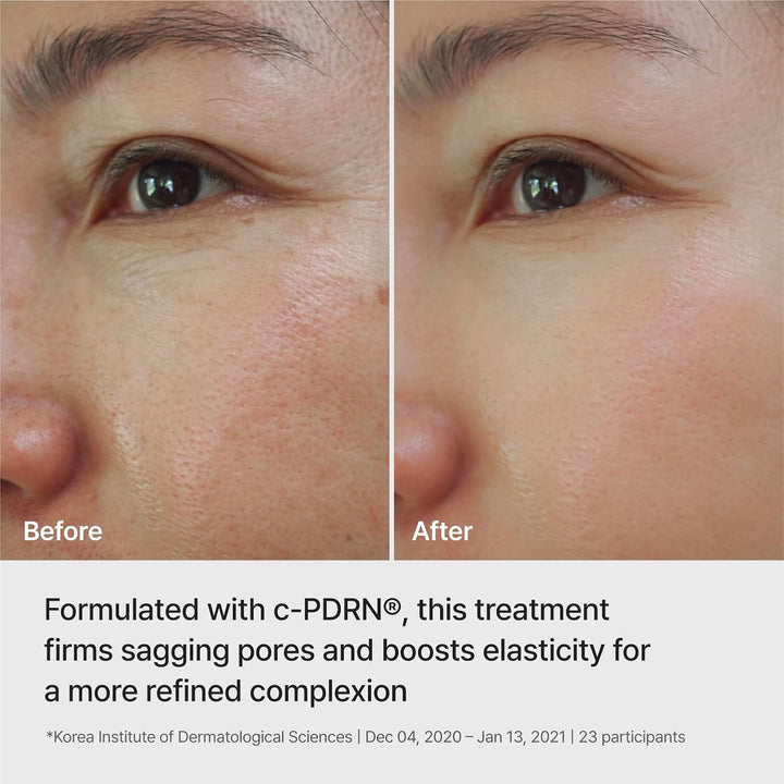 REJURAN® Máscara de elevación con infusión de ampolla, DOT™ c-PDRN®...