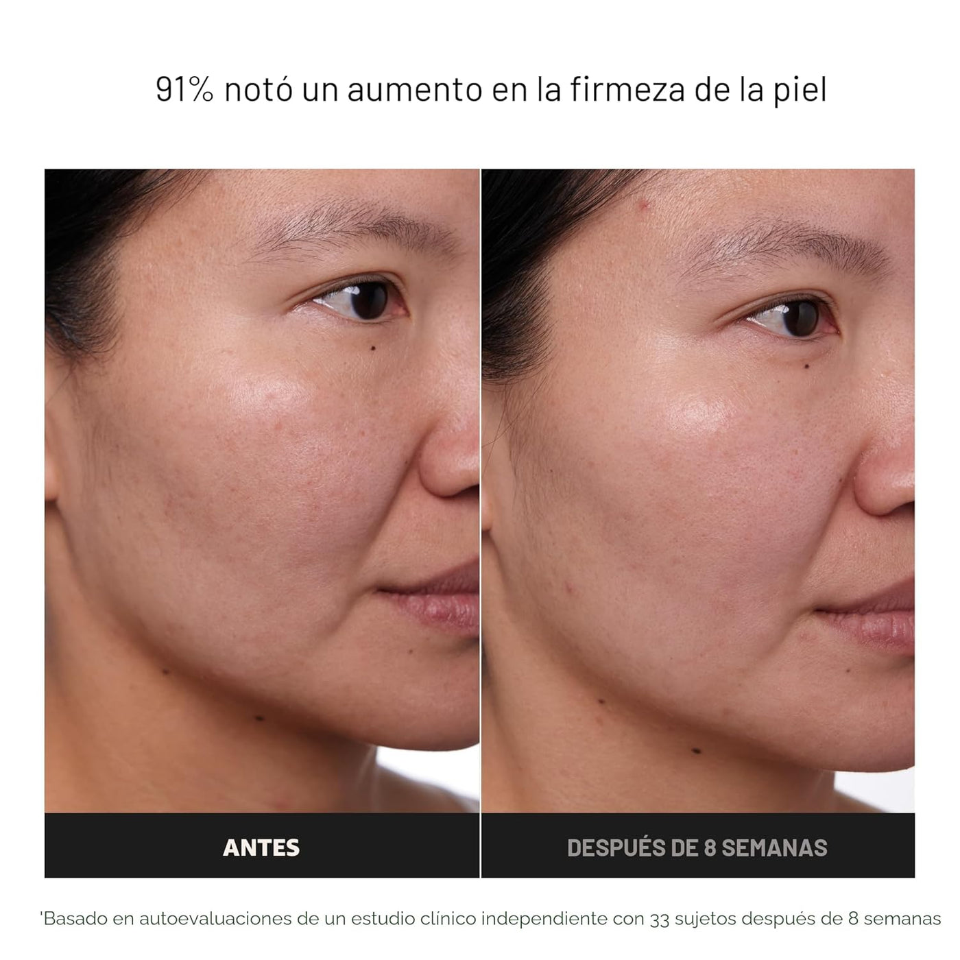 Paula's Choice CLINICAL 1% Retinol Crema Tratamiento
