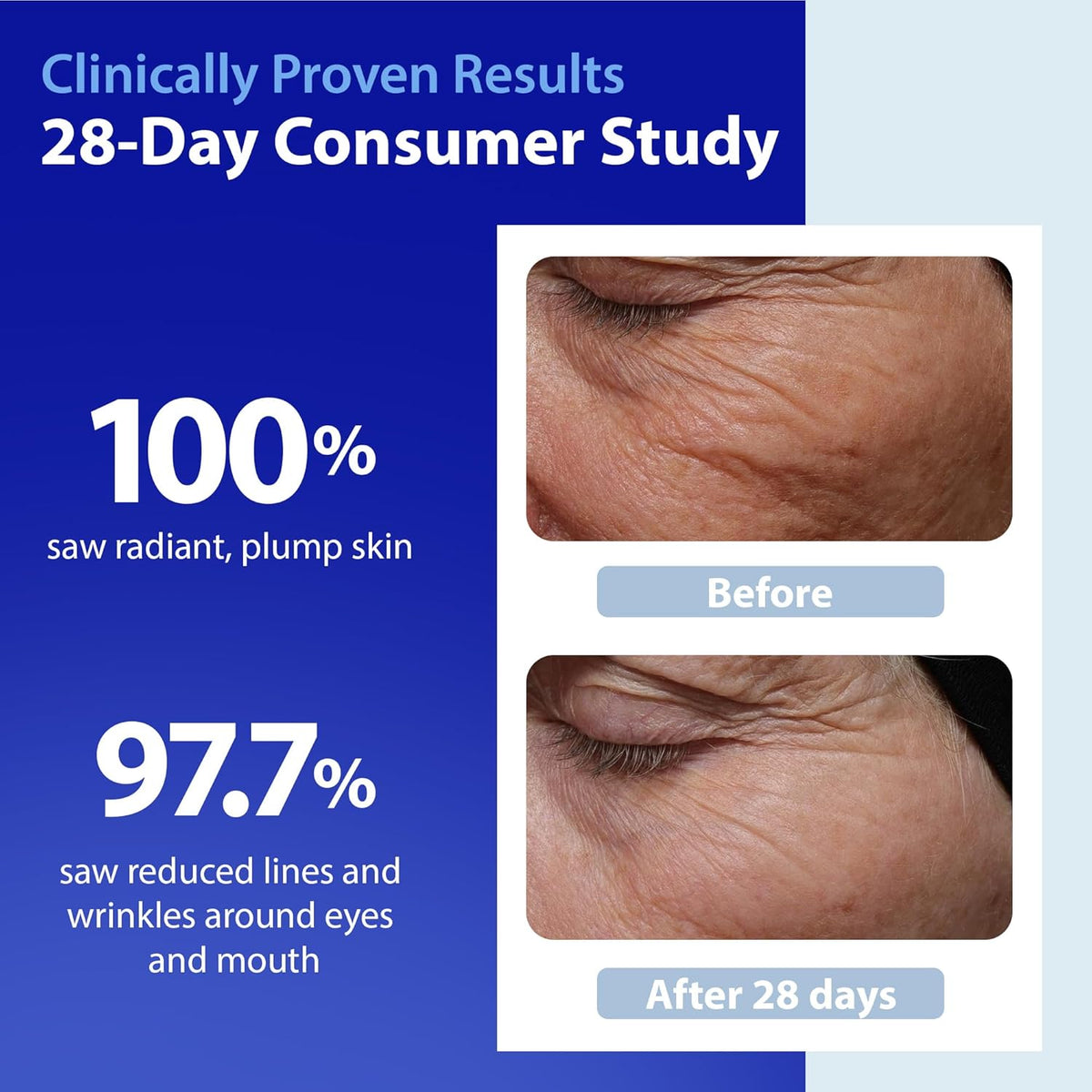 Dr. Denese SkinScience HydroShield - Suero facial ultra hidratante...