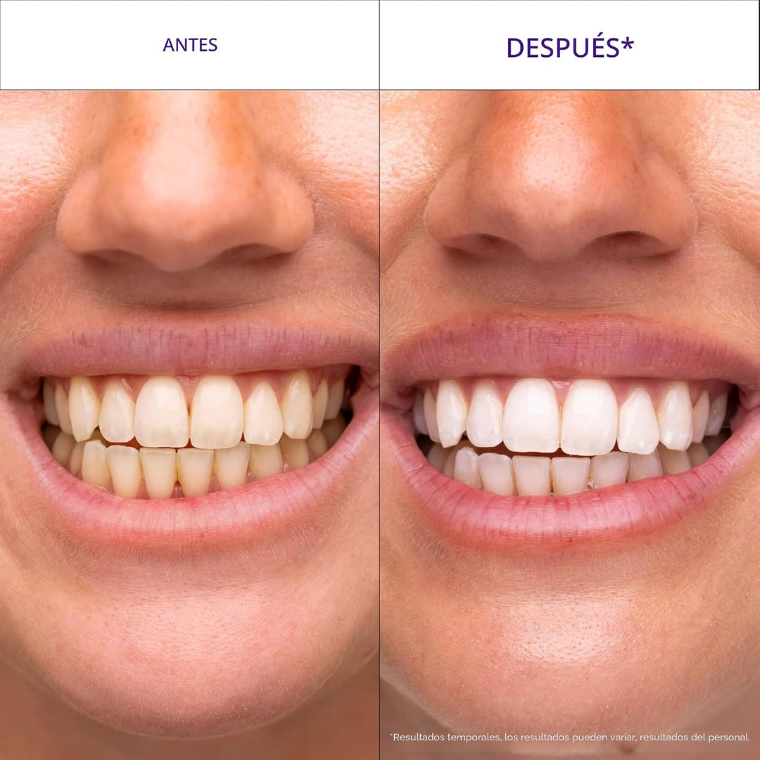 Hismile V34 Tiras blanqueadoras, tiras blanqueadoras de dientes, ti...