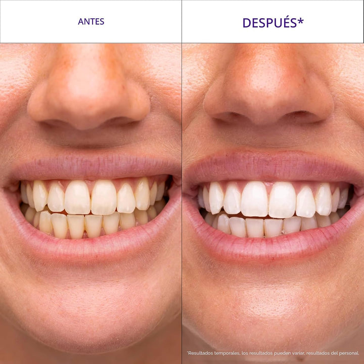 Hismile V34 Tiras blanqueadoras, tiras blanqueadoras de dientes, ti...